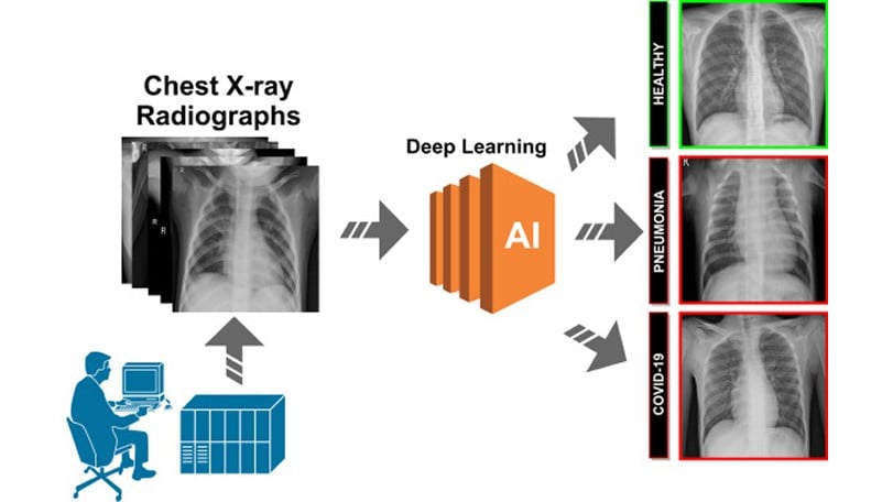 Deep Learning Automation: Breaking the 6-Hour Barrier in Spine Analysis 9 AI-Driven Automation for Workflow Optimization