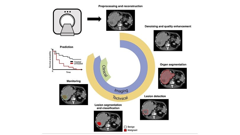 Deep Learning Automation: Breaking the 6-Hour Barrier in Spine Analysis 12 Model Architectures Enabling Rapid Analysis